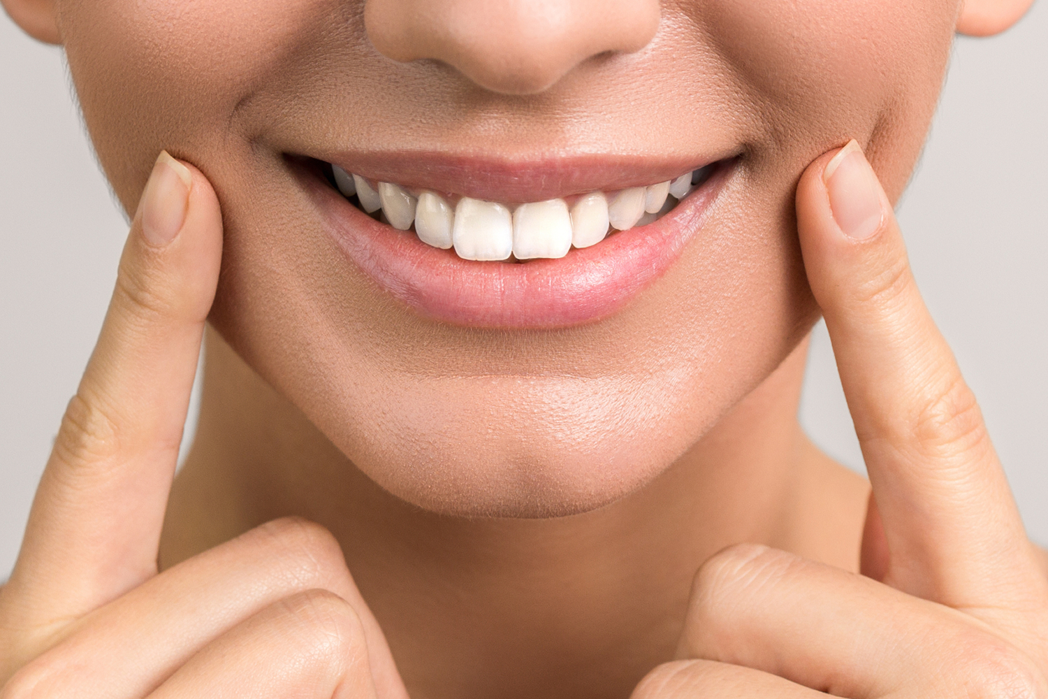 Sourire illustrant la chirurgie orthognathique